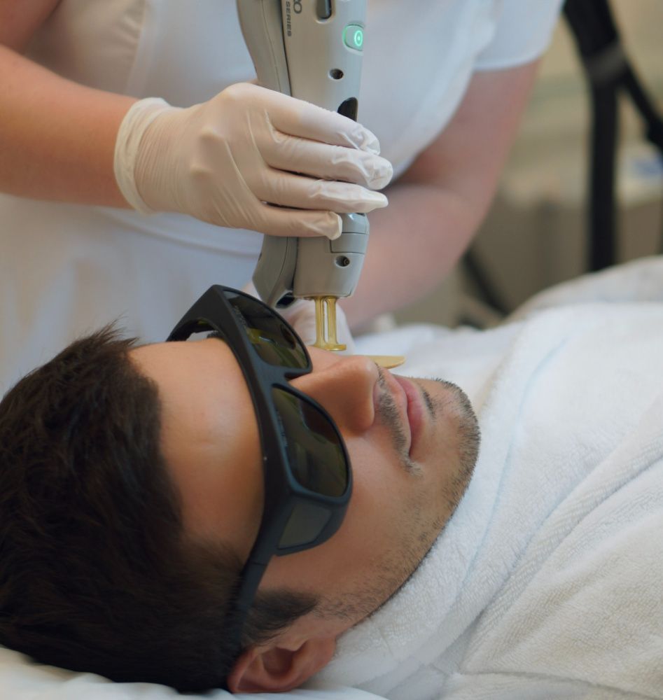 Мужская лазерная эпиляция